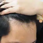 Zink voor gezond en sterk haar - Hoeveelheid, voeding en supplementen