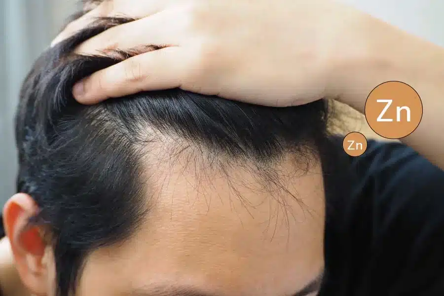 Zink voor gezond en sterk haar - Hoeveelheid, voeding en supplementen